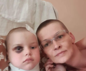 Poruszający gest mamy 5-latki, którą przygniótł krzyż. Chce wyglądać jak córka