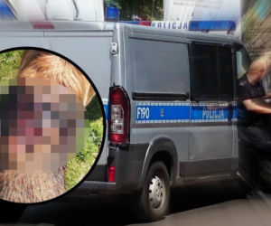 Zwyrodnialec zaatakował psa sąsiada maczetą