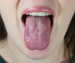 Ten grzyb żyje w twoim ciele. Może napędzać najgroźniejszy nowotwór skóry