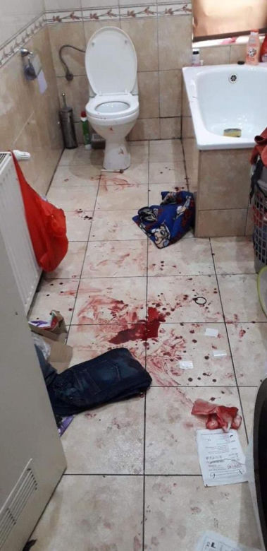 Zazdrośnik pociął żonę tulipanem
