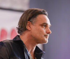 Jan Wieczorkowski przed przeszczepem włosów