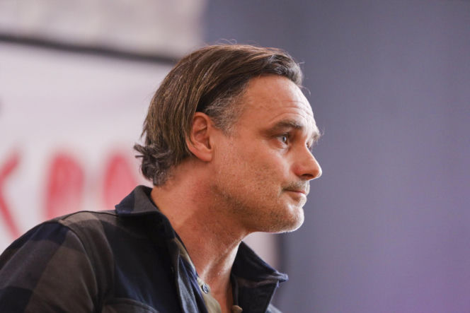 Jan Wieczorkowski przed przeszczepem włosów