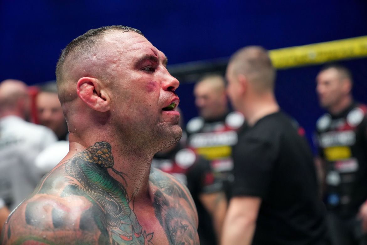 Paczuski: Potworne rozcięcie na twarzy gwiazdy KSW