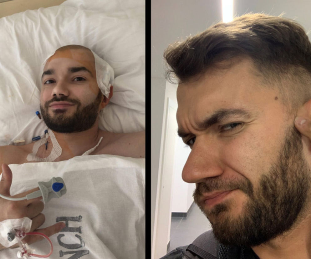 Sebastian rozpoczyna drugą wojnę z glejakiem. Dramatyczny apel o pomoc