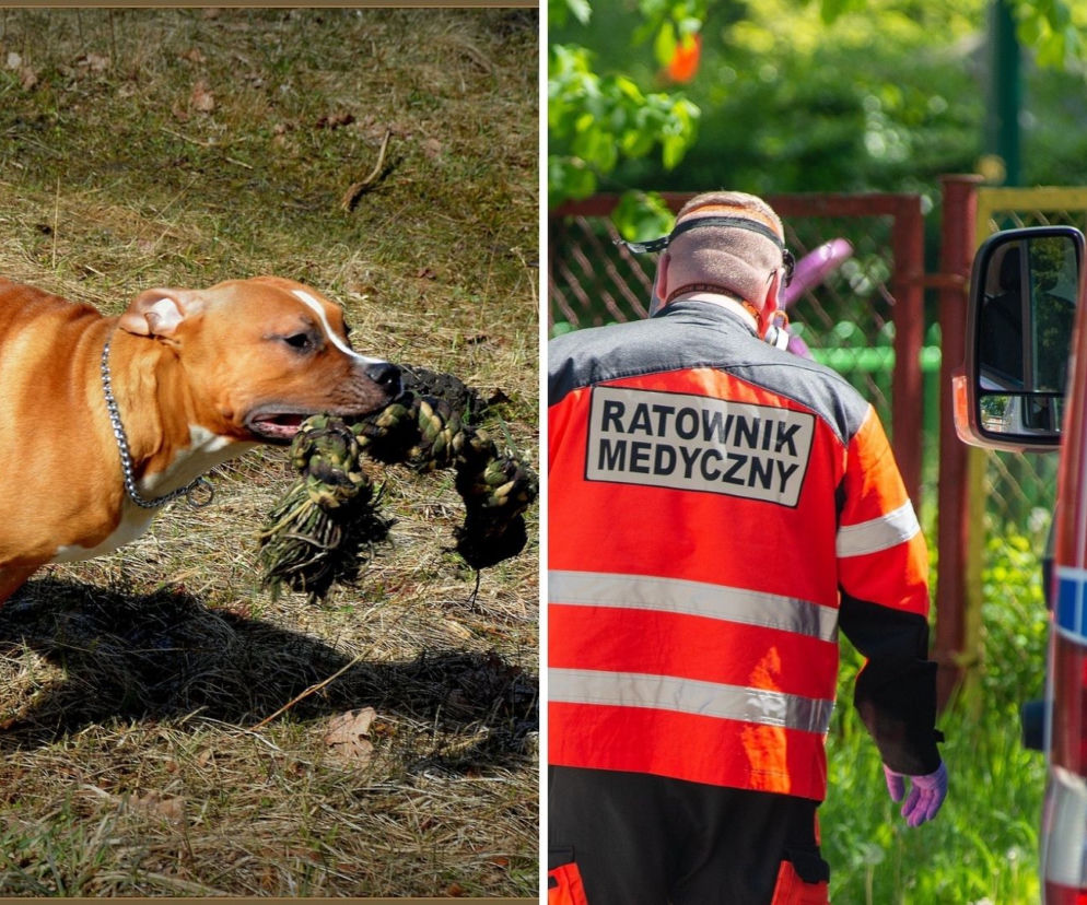 Pies przebił płuco i rozszarpał szyję 12-letniego Kamila. Właściciel się DOIGRAŁ [WIDEO]