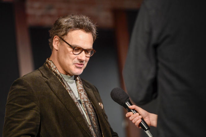 Jan Wieczorkowski przed przeszczepem włosów