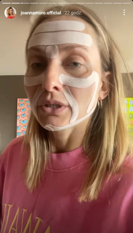 Co Joanna Moro zrobiła z twarzą?