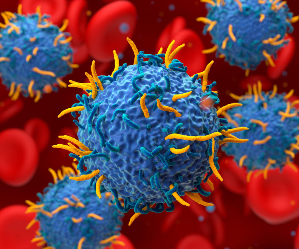 Niebieskie limfocyty T z żółtymi i jasnoniebieskimi wypustkami w otoczeniu czerwonych krwinek, symbolizujące terapię CAR-T w leczeniu nowotworów krwi. Więcej o tej przełomowej metodzie leczenia można przeczytać na portalu Poradnik Zdrowie.