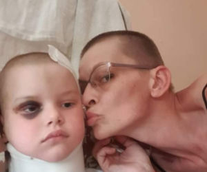 Poruszający gest mamy 5-latki, którą przygniótł krzyż. Chce wyglądać jak córka