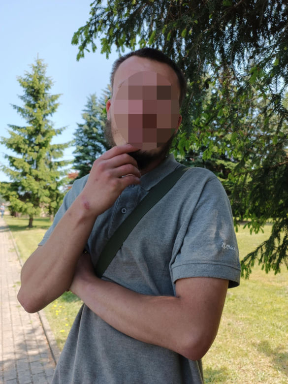Zamienili życie 20-letniego Tomka w koszmar. Zrobili mu TO kijem od szczotki 