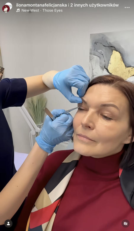 Ilona Felicjańska wycina sobie powieki