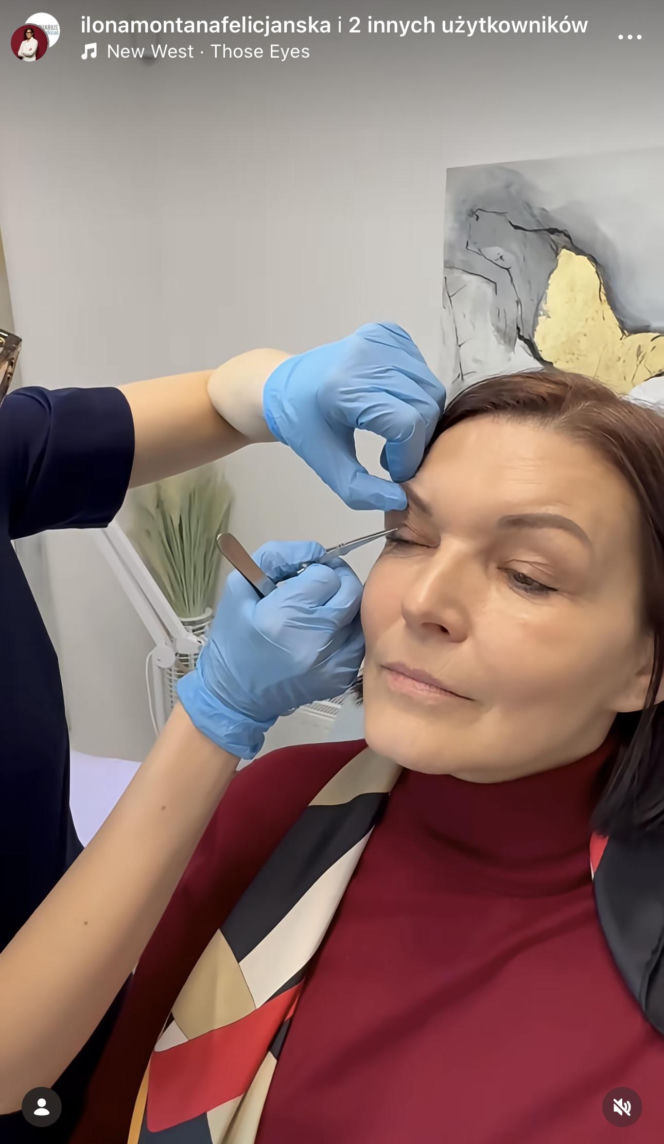 Ilona Felicjańska wycina sobie powieki