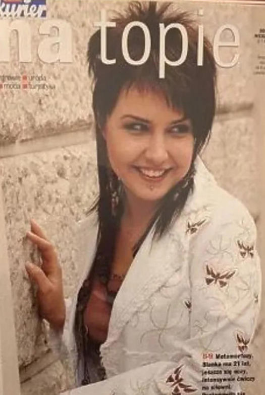 Blanka Lipińska, operacje plastyczne