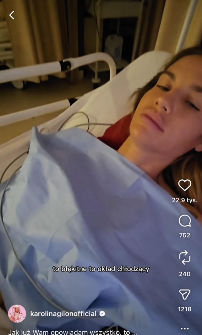 Karolina Gilon zoperowała biust. Zdjęcia przed i po