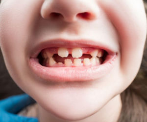 Krzywe zęby u dziecka? Zwróć uwagę, co jego język robi w spoczynku