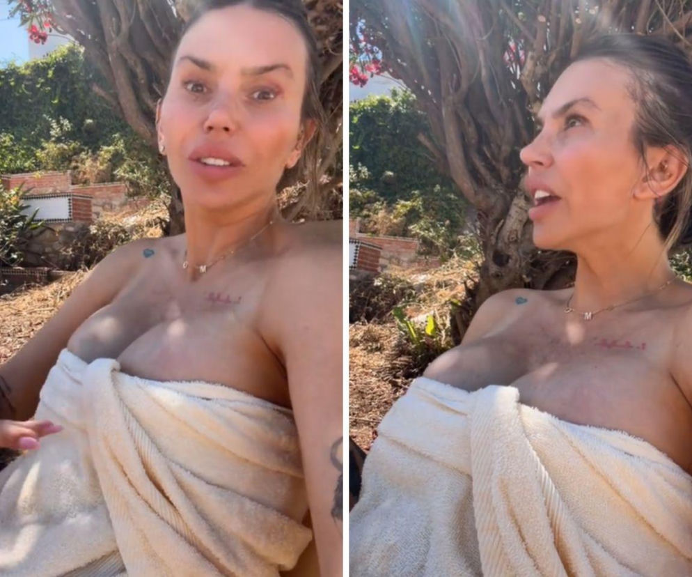 Monika Goździalska w beżowym ręczniku na tle drzew, rozprawiająca o upale, prezentuje swoje ciało po interwencjach chirurgicznych, w tym widoczne blizny na klatce piersiowej. Więcej o jej bezkompromisowych wypowiedziach przeczytasz na naszym portalu.