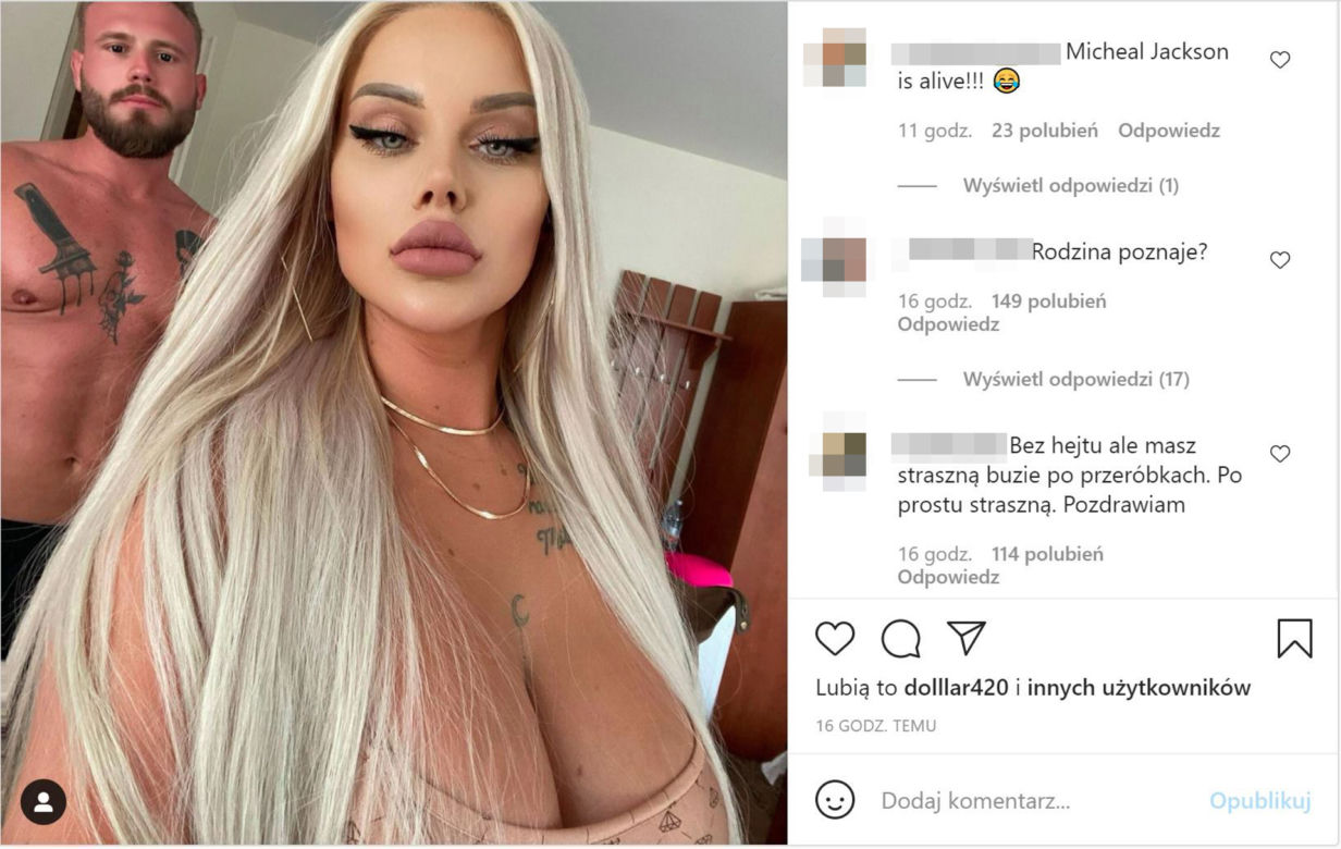 Ewelina z Warsaw Shore przesadziła z operacjami