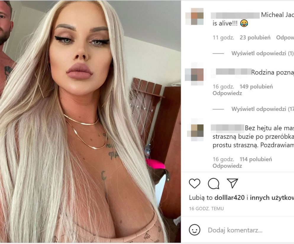 Ewelina z Warsaw Shore przesadziła z operacjami