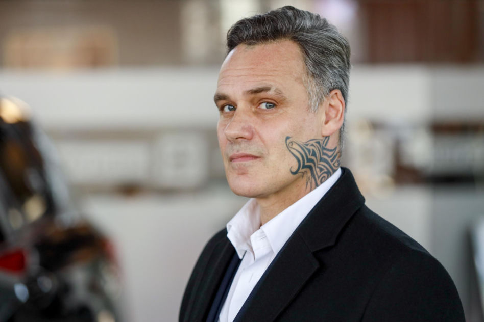 Jan Wieczorkowski przed przeszczepem włosów