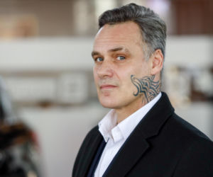 Jan Wieczorkowski przed przeszczepem włosów