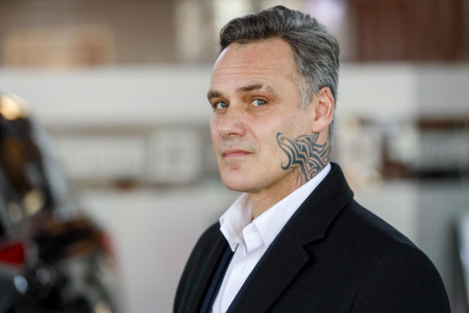 Jan Wieczorkowski przed przeszczepem włosów