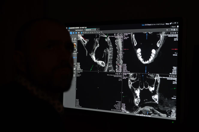 Egipska mumia trafiła do szpitala w Lublinie