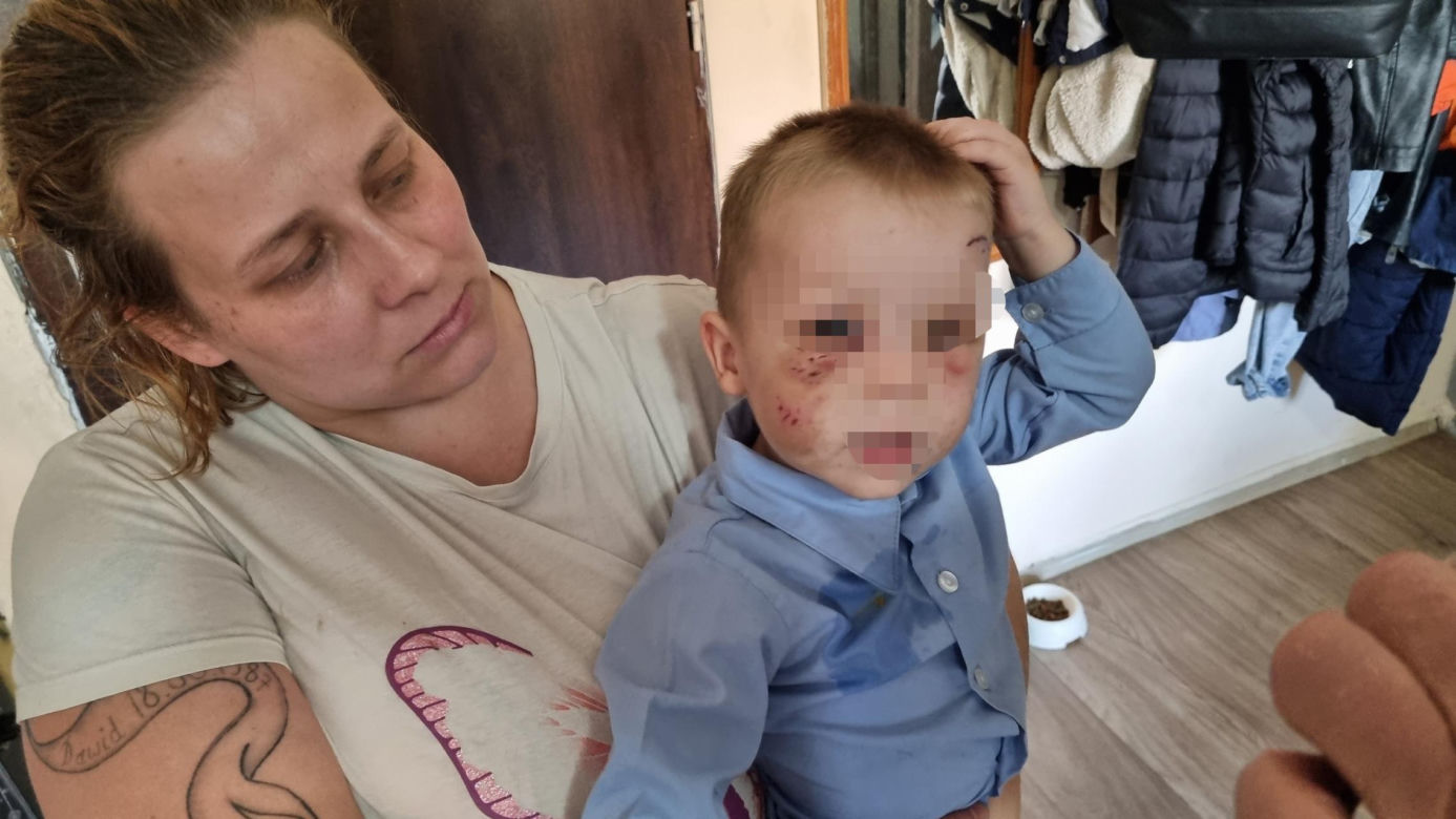 Pies pogryzł 3-latka na przystanku