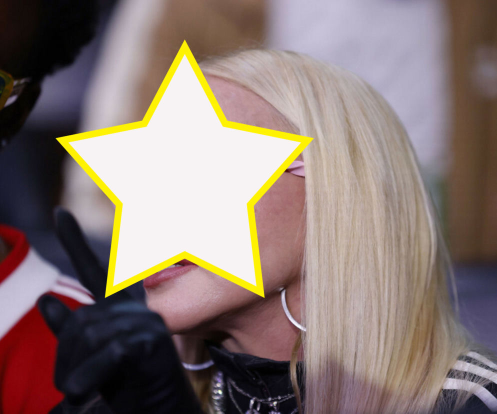 Madonna ma nową twarz! 64-latka przeszła kolejne operacje?