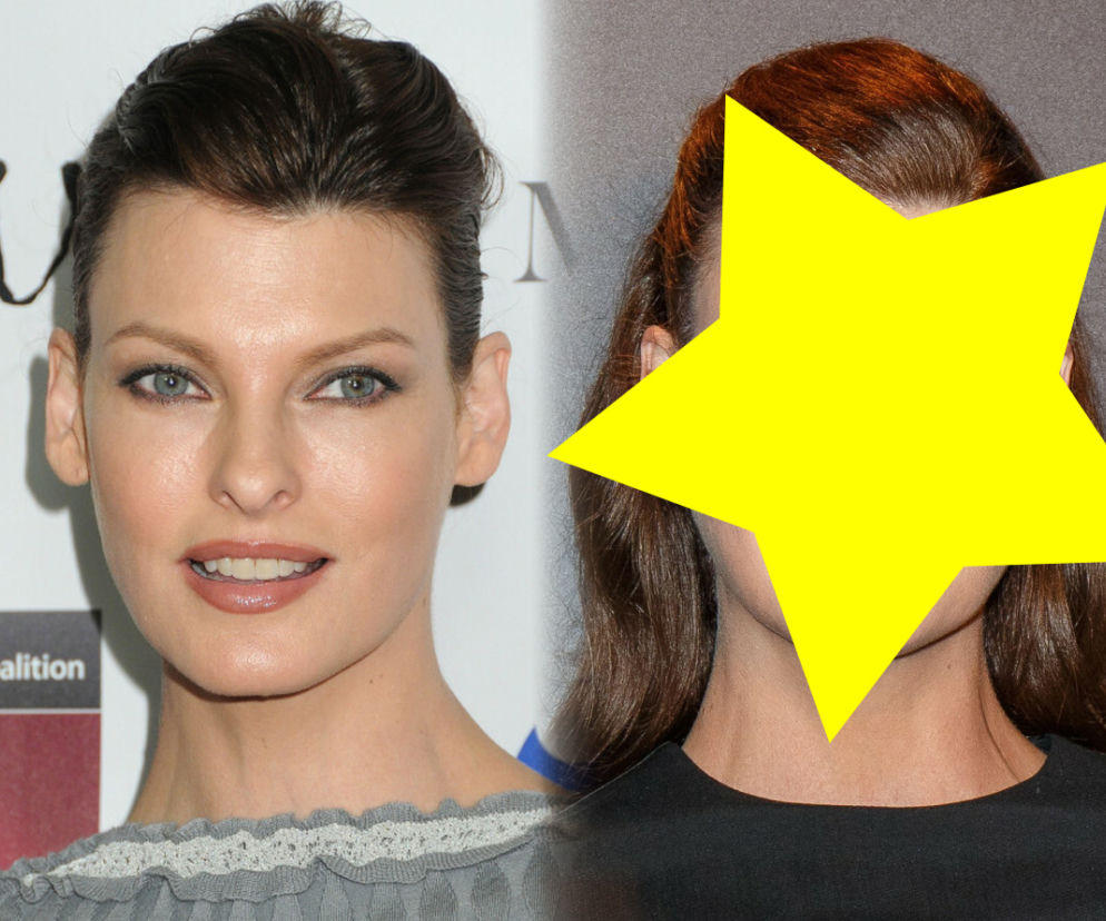 Była supermodelką, teraz ukrywa się po nieudanym zabiegu. Linda Evangelista oszpecona