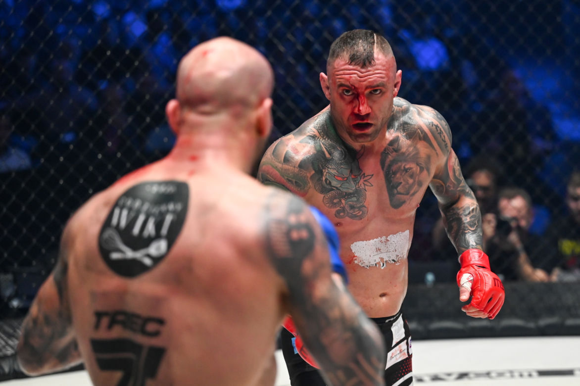 Paczuski: Potworne rozcięcie na twarzy gwiazdy KSW