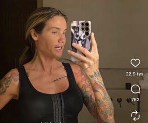 Karolina Gilon zoperowała biust. Zdjęcia przed i po