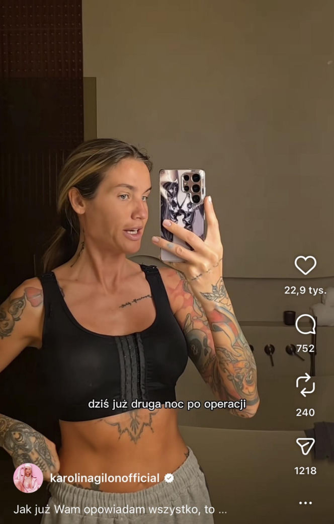 Karolina Gilon zoperowała biust. Zdjęcia przed i po