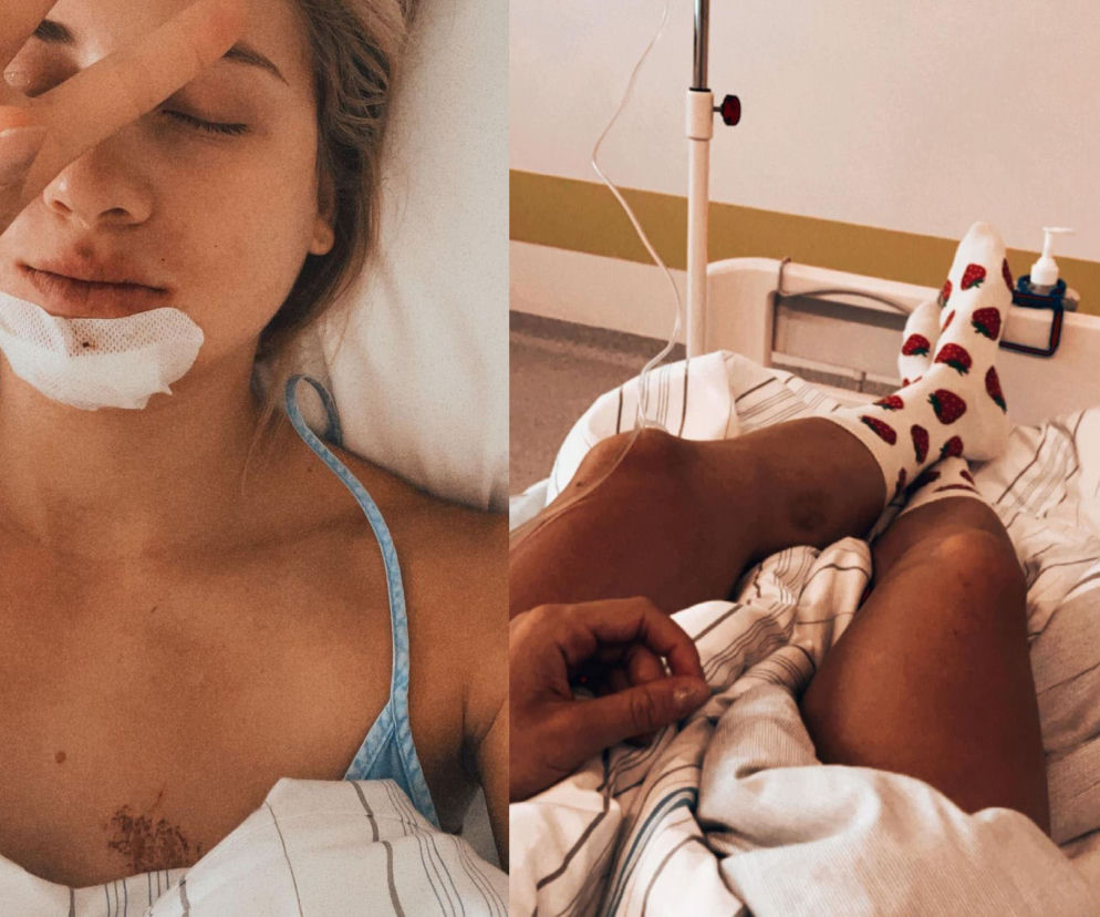 Narciarstwo biegowe, biegi narciarskie, Izabela Marcisz, uraz, szpital, kontuzja
