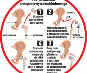 Mąż zapłacił 30 tys. za nowe biodro Maryli Rodowicz