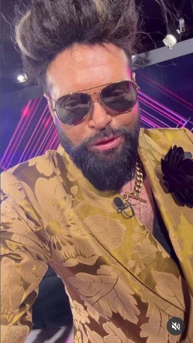 Fryzura Rutkowskiego żyje własnym życiem. Szok, co teraz znalazło się na jego głowie