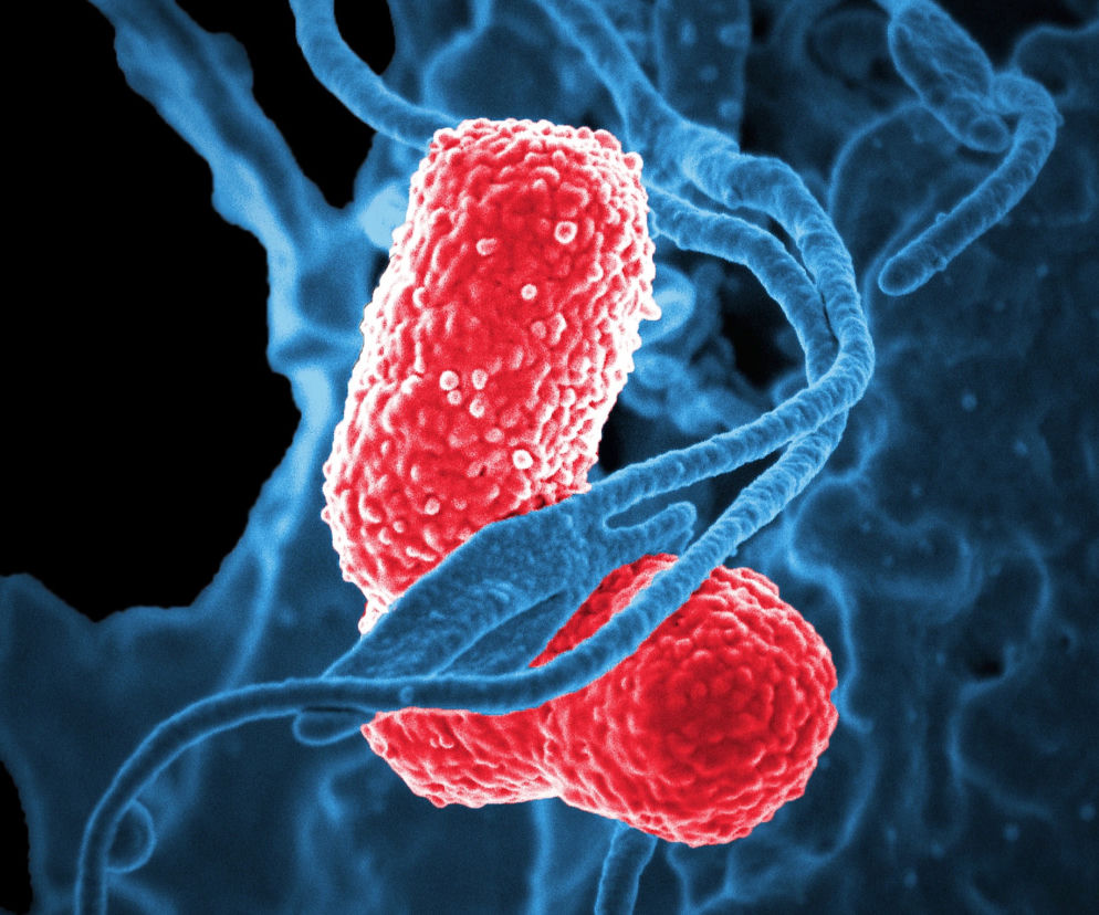 Bakteria New Delhi atakuje z coraz większą siłą. Będzie epidemia?