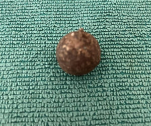 Pasjonaci historii znaleźli skarby sprzed 2 tysięcy lat