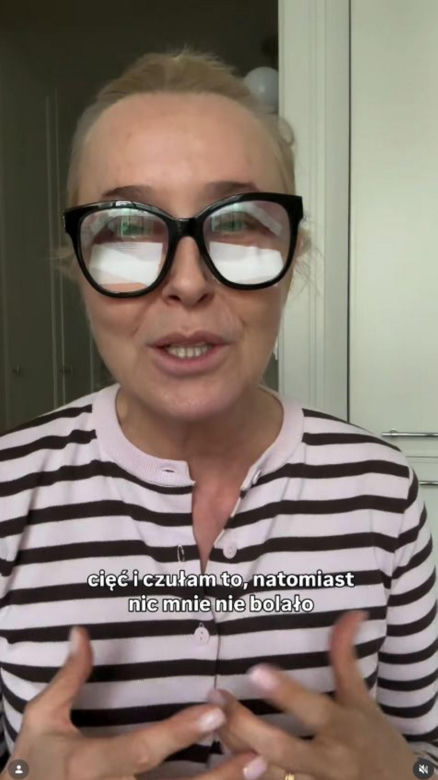 Agata Młynarska wycięła sobie powieki
