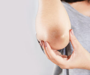 Nie znikają mimo kremów? To ważna wskazówka. Ciemne łokcie mogą być pierwszym objawem „cichej” choroby