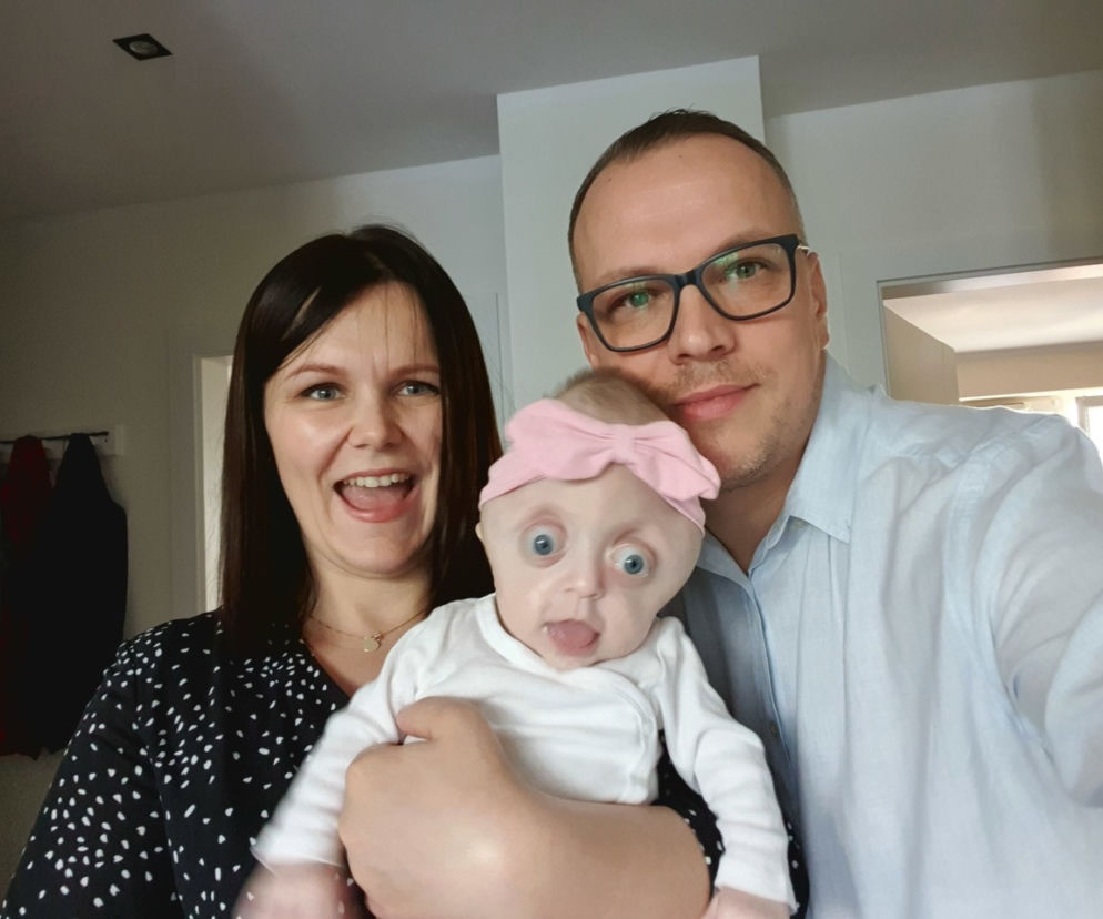 Mówili im: Pani dziecko to potwór, lepiej żeby umarło. Rodzice WALCZĄ o małą Hanię! 