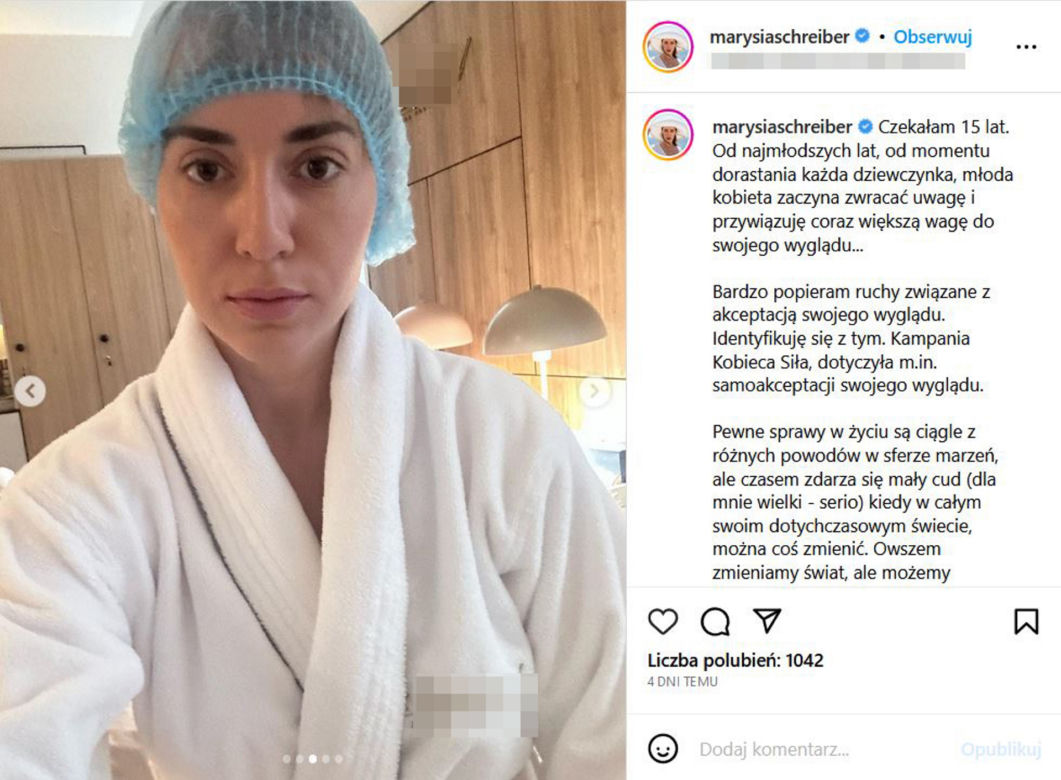 Tak wygląda Marianna Schreiber po operacji nosa