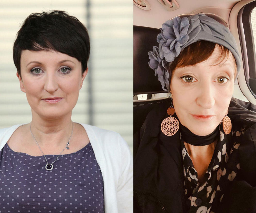 Agnieszka Burzyńska przeszła poważne problemy zdrowotne