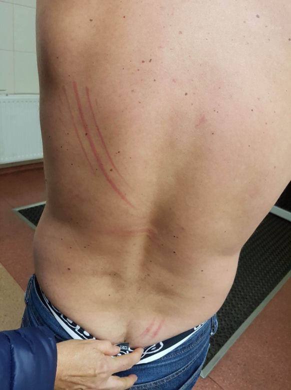 Dostałem zawału przez policję