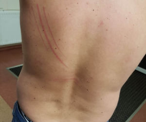 Dostałem zawału przez policję