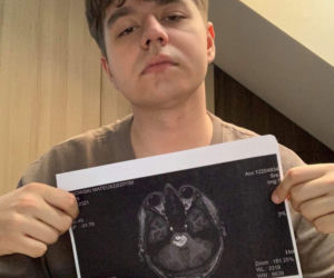 Mateusz ma dwadzieścia lat i guza mózgu 