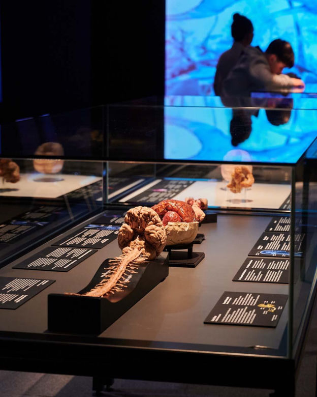 Body Worlds