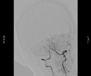 W Mazowieckim Szpitalu Specjalistycznym przeprowadzono nowatorskie zabiegi neurologiczne