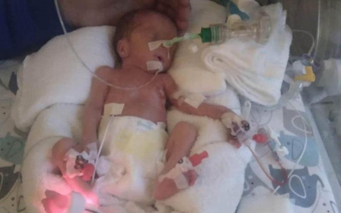 Dzień Wcześniaka w Szpitalu św. Zofii w Warszawie