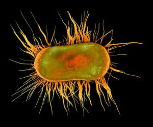 Bakteria E. coli