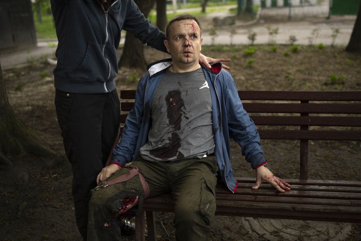 Horror na Ukrainie. Wojna zbiera przerażające żniwo